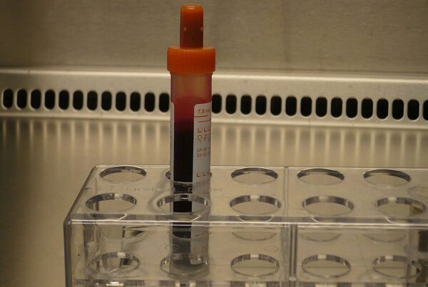 Provetta contenente un campione di sangue in un laboratorio clinico, immagine illustrativa del prelievo