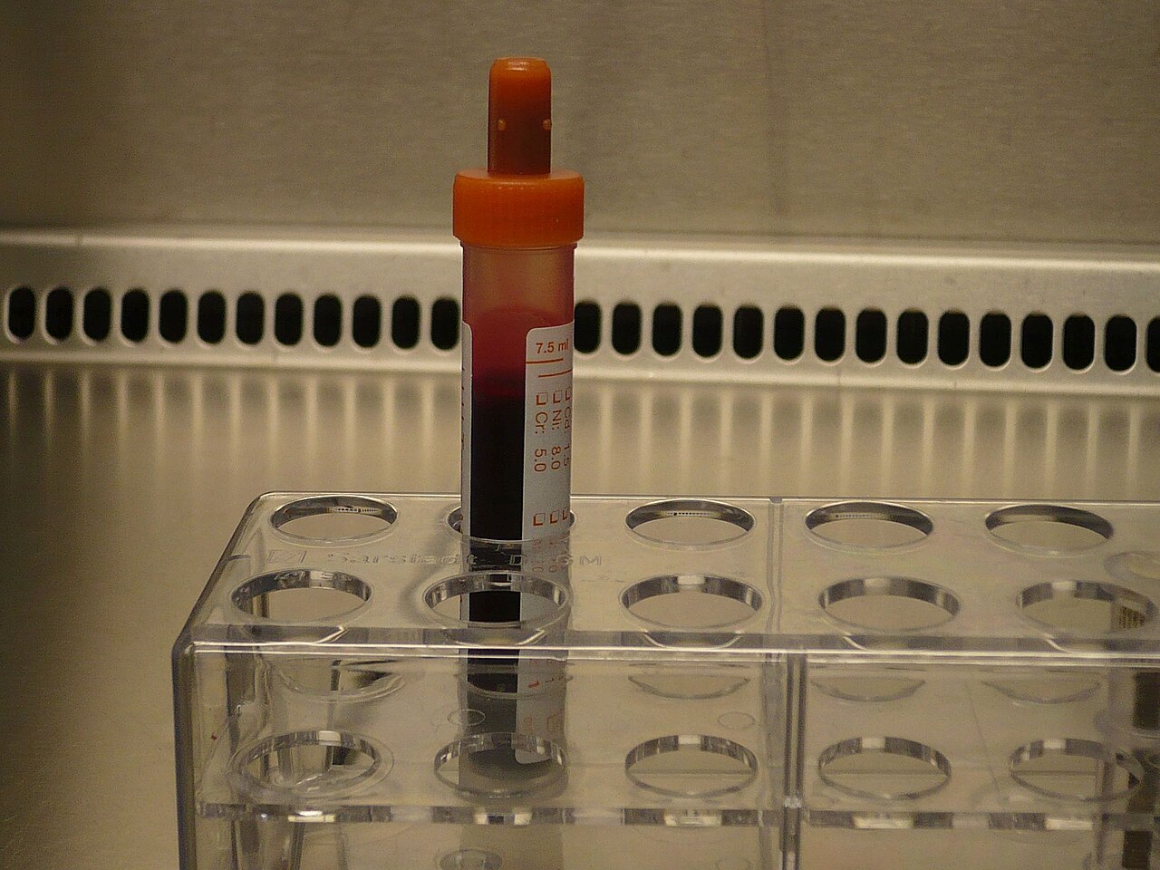 Provetta contenente un campione di sangue in un laboratorio clinico, immagine illustrativa del prelievo