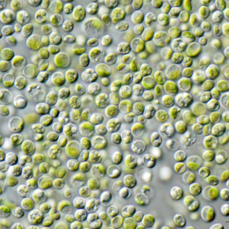 Microfotografia al microscopio di cellule della microalga verde Chlorella vulgaris